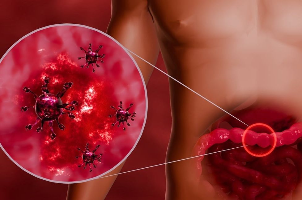 Opasni virus počeo da se širi prije praznika: Ovo su simptomi! - featured image Opasni virus počeo da se širi prije praznika: Ovo su simptomi! - featured image