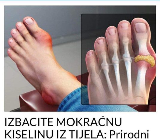 IZBACITE MOKRAĆNU KISELINU IZ TIJELA, IZBACITE GIHT: 3 Narodna Lijeka Koja Provjereno Djeluju, OVO ĆE VAM POMOĆI! (RECEPT) IZBACITE MOKRAĆNU KISELINU IZ TIJELA, IZBACITE GIHT: 3 Narodna Lijeka Koja Provjereno Djeluju, OVO ĆE VAM POMOĆI! (RECEPT) - featured image