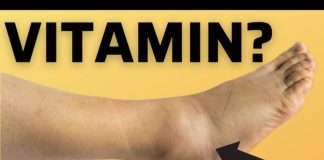 OVO JE VITAMIN br.1 za uklanjanje oteklina nogu i stopala! OVO JE VITAMIN br.1 za uklanjanje oteklina nogu i stopala! - featured image