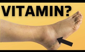 OVO JE VITAMIN br.1 za uklanjanje oteklina nogu i stopala! OVO JE VITAMIN br.1 za uklanjanje oteklina nogu i stopala! - featured image
