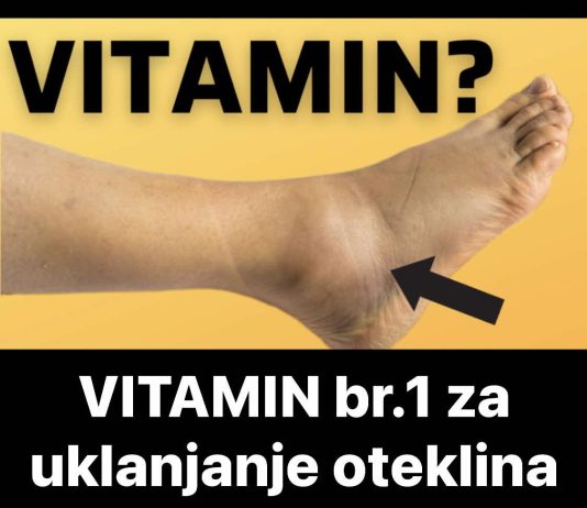 OVO JE VITAMIN br.1 za uklanjanje oteklina nogu i stopala! OVO JE VITAMIN br.1 za uklanjanje oteklina nogu i stopala! - featured image