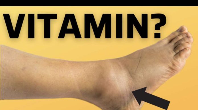 OVO JE VITAMIN br.1 za uklanjanje oteklina nogu i stopala! OVO JE VITAMIN br.1 za uklanjanje oteklina nogu i stopala! - featured image