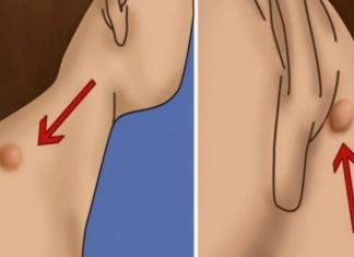 POJAVILA VAM SE KVRŽICA NA VRATU, LEĐIMA ILI IZA UHA? Evo šta to znači! POJAVILA VAM SE KVRŽICA NA VRATU, LEĐIMA ILI IZA UHA? Evo šta to znači! - featured image