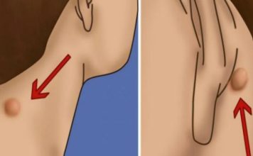 POJAVILA VAM SE KVRŽICA NA VRATU, LEĐIMA ILI IZA UHA? Evo šta to znači! POJAVILA VAM SE KVRŽICA NA VRATU, LEĐIMA ILI IZA UHA? Evo šta to znači! - featured image