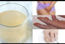 KANDIDA UNIŠTAVA ORGANIZAM I IMUNITET: Napravite ovaj napitak I ZAUVIJEK JE SE RIJEŠITE (RECEPT) KANDIDA UNIŠTAVA ORGANIZAM I IMUNITET: Napravite ovaj napitak I ZAUVIJEK JE SE RIJEŠITE (RECEPT) - featured image