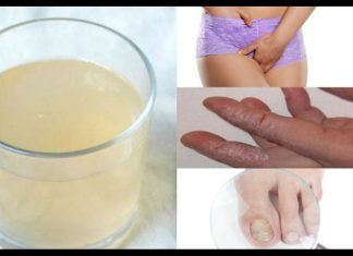 KANDIDA UNIŠTAVA ORGANIZAM I IMUNITET: Napravite ovaj napitak I ZAUVIJEK JE SE RIJEŠITE (RECEPT) KANDIDA UNIŠTAVA ORGANIZAM I IMUNITET: Napravite ovaj napitak I ZAUVIJEK JE SE RIJEŠITE (RECEPT) - featured image