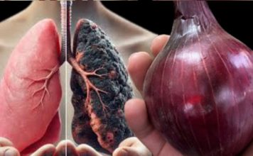 Očistite pluća ❗ Prestanite kašljati za samo 3 dana uz ovaj lijek od luka Očistite pluća ❗ Prestanite kašljati za samo 3 dana uz ovaj lijek od luka - featured image