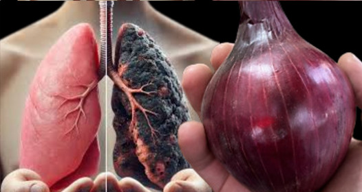 Očistite pluća ❗ Prestanite kašljati za samo 3 dana uz ovaj lijek od luka Očistite pluća ❗ Prestanite kašljati za samo 3 dana uz ovaj lijek od luka - featured image