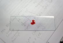 TI SI NULA, ZNAČI DA SI POSEBAN: Osobe sa tom krvnom grupom imaju “moći” kakve drugi sanjaju! TI SI NULA, ZNAČI DA SI POSEBAN: Osobe sa tom krvnom grupom imaju “moći” kakve drugi sanjaju! - featured image