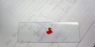 TI SI NULA, ZNAČI DA SI POSEBAN: Osobe sa tom krvnom grupom imaju “moći” kakve drugi sanjaju! TI SI NULA, ZNAČI DA SI POSEBAN: Osobe sa tom krvnom grupom imaju “moći” kakve drugi sanjaju! - featured image