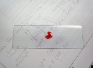 TI SI NULA, ZNAČI DA SI POSEBAN: Osobe sa tom krvnom grupom imaju “moći” kakve drugi sanjaju! TI SI NULA, ZNAČI DA SI POSEBAN: Osobe sa tom krvnom grupom imaju “moći” kakve drugi sanjaju! - featured image