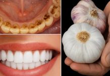 🦷✨ TAJNA KOJU STOMATOLOZI NE ŽELE OTKRITI: UKLONITE KAMENAC I IZBIJELITE ZUBE ZA SAMO 2 MINUTE!** 😲 🦷✨ TAJNA KOJU STOMATOLOZI NE ŽELE OTKRITI: UKLONITE KAMENAC I IZBIJELITE ZUBE ZA SAMO 2 MINUTE!** 😲 - featured image