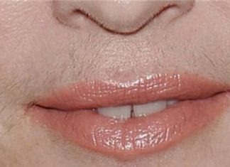 UKLONILA SAM BRKOVE ZA MINUTU I ONI VIŠE NE RASTU: Ako i vi muku mučite sa DLAČICAMA, odmah napravite ovu smjesu od 3 SASTOJKA UKLONILA SAM BRKOVE ZA MINUTU I ONI VIŠE NE RASTU: Ako i vi muku mučite sa DLAČICAMA, odmah napravite ovu smjesu od 3 SASTOJKA - featured image