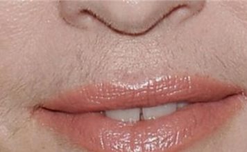 UKLONILA SAM BRKOVE ZA MINUTU I ONI VIŠE NE RASTU: Ako i vi muku mučite sa DLAČICAMA, odmah napravite ovu smjesu od 3 SASTOJKA UKLONILA SAM BRKOVE ZA MINUTU I ONI VIŠE NE RASTU: Ako i vi muku mučite sa DLAČICAMA, odmah napravite ovu smjesu od 3 SASTOJKA - featured image