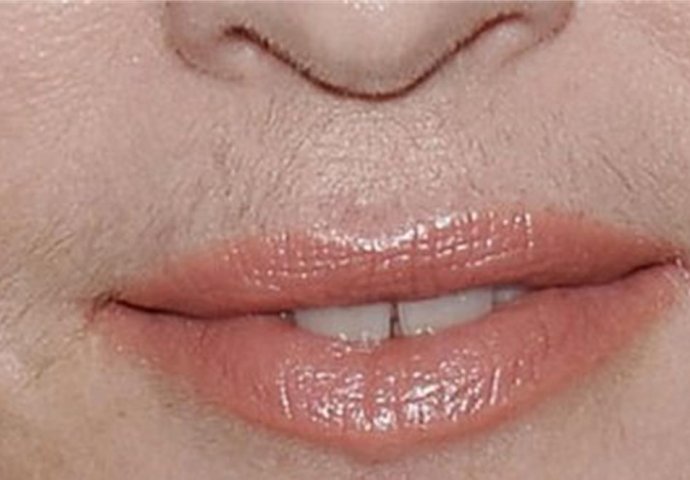 UKLONILA SAM BRKOVE ZA MINUTU I ONI VIŠE NE RASTU: Ako i vi muku mučite sa DLAČICAMA, odmah napravite ovu smjesu od 3 SASTOJKA - featured image UKLONILA SAM BRKOVE ZA MINUTU I ONI VIŠE NE RASTU: Ako i vi muku mučite sa DLAČICAMA, odmah napravite ovu smjesu od 3 SASTOJKA - featured image