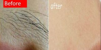 SVAKA ŽENA ZASLUŽUJE DA ZNA: Prirodnim putem uklonite brkove i druge neželjene dlačice sa tijela zauvijek SVAKA ŽENA ZASLUŽUJE DA ZNA: Prirodnim putem uklonite brkove i druge neželjene dlačice sa tijela zauvijek - featured image