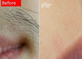 SVAKA ŽENA ZASLUŽUJE DA ZNA: Prirodnim putem uklonite brkove i druge neželjene dlačice sa tijela zauvijek SVAKA ŽENA ZASLUŽUJE DA ZNA: Prirodnim putem uklonite brkove i druge neželjene dlačice sa tijela zauvijek - featured image