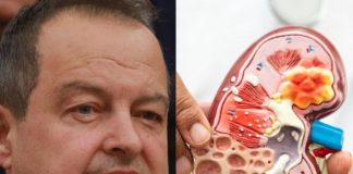 Ivica Dačić ne boluje samo od upale pluća, ovu bolest je ignorisao godinama, a tiho razara organe Ivica Dačić ne boluje samo od upale pluća, ovu bolest je ignorisao godinama, a tiho razara organe - featured image
