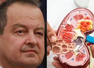Ivica Dačić ne boluje samo od upale pluća, ovu bolest je ignorisao godinama, a tiho razara organe Ivica Dačić ne boluje samo od upale pluća, ovu bolest je ignorisao godinama, a tiho razara organe - featured image