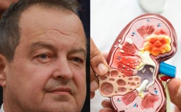 Ivica Dačić ne boluje samo od upale pluća, ovu bolest je ignorisao godinama, a tiho razara organe Ivica Dačić ne boluje samo od upale pluća, ovu bolest je ignorisao godinama, a tiho razara organe - featured image