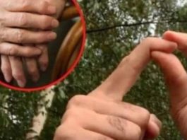 0BL0G K0JI IZVLAČI SAV B0L IZ TIJELA: PR0VJEREN lijek za reumu, išijas, giht i artritis… 0BL0G K0JI IZVLAČI SAV B0L IZ TIJELA: PR0VJEREN lijek za reumu, išijas, giht i artritis… - featured image