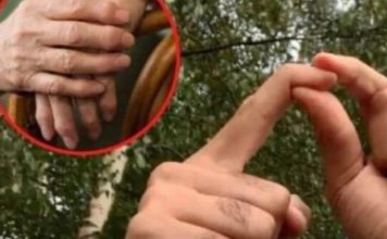 0BL0G K0JI IZVLAČI SAV B0L IZ TIJELA: PR0VJEREN lijek za reumu, išijas, giht i artritis… 0BL0G K0JI IZVLAČI SAV B0L IZ TIJELA: PR0VJEREN lijek za reumu, išijas, giht i artritis… - featured image