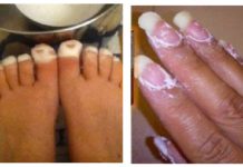 Nikako nisam mogla ukloniti gljivice s noktiju, sve dok nisam namazala OVO Nikako nisam mogla ukloniti gljivice s noktiju, sve dok nisam namazala OVO - featured image