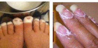 Nikako nisam mogla ukloniti gljivice s noktiju, sve dok nisam namazala OVO Nikako nisam mogla ukloniti gljivice s noktiju, sve dok nisam namazala OVO - featured image