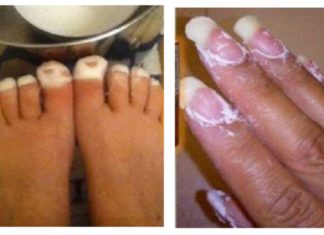 Nikako nisam mogla ukloniti gljivice s noktiju, sve dok nisam namazala OVO Nikako nisam mogla ukloniti gljivice s noktiju, sve dok nisam namazala OVO - featured image