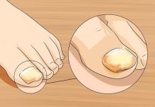 SINOĆ SAM NAMAZALA OVU SMJESU NA GLJIVICE NA NOKTIMA: One su nestale kao rukom odnešene, GENIJALAN RECEPT MI SPASIO ŽIVOT SINOĆ SAM NAMAZALA OVU SMJESU NA GLJIVICE NA NOKTIMA: One su nestale kao rukom odnešene, GENIJALAN RECEPT MI SPASIO ŽIVOT - featured image