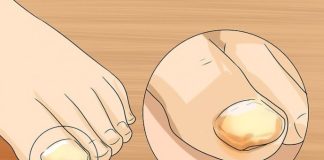 SINOĆ SAM NAMAZALA OVU SMJESU NA GLJIVICE NA NOKTIMA: One su nestale kao rukom odnešene, GENIJALAN RECEPT MI SPASIO ŽIVOT SINOĆ SAM NAMAZALA OVU SMJESU NA GLJIVICE NA NOKTIMA: One su nestale kao rukom odnešene, GENIJALAN RECEPT MI SPASIO ŽIVOT - featured image