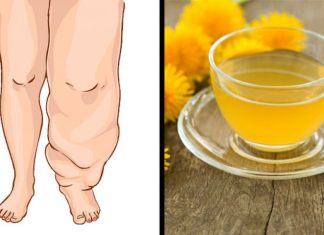 OVIH DESET NAMIRNICA ĆE VAS OSLOBODITI VIŠKA VODE U TIJELU: Probajte ove prirodne diuretike! OVIH DESET NAMIRNICA ĆE VAS OSLOBODITI VIŠKA VODE U TIJELU: Probajte ove prirodne diuretike! - featured image