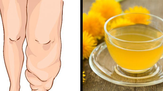 OVIH DESET NAMIRNICA ĆE VAS OSLOBODITI VIŠKA VODE U TIJELU: Probajte ove prirodne diuretike! OVIH DESET NAMIRNICA ĆE VAS OSLOBODITI VIŠKA VODE U TIJELU: Probajte ove prirodne diuretike! - featured image