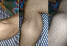 GRČEVI U NOGAMA SU OPASAN SIMPTOM: Evo na šta ukazuje bol u listovima i butinama GRČEVI U NOGAMA SU OPASAN SIMPTOM: Evo na šta ukazuje bol u listovima i butinama - featured image