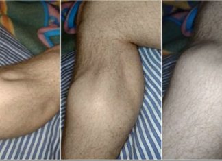 GRČEVI U NOGAMA SU OPASAN SIMPTOM: Evo na šta ukazuje bol u listovima i butinama GRČEVI U NOGAMA SU OPASAN SIMPTOM: Evo na šta ukazuje bol u listovima i butinama - featured image