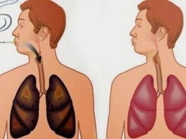 ISPRALA SAM KATRAN SA PLUĆA ZA SAMO 72 SATA I DOKTORI SU BILI IZNENAĐENI: Ovaj napitak čisti organizam, PROBAJTE I UVJERITE SE SAMI ISPRALA SAM KATRAN SA PLUĆA ZA SAMO 72 SATA I DOKTORI SU BILI IZNENAĐENI: Ovaj napitak čisti organizam, PROBAJTE I UVJERITE SE SAMI - featured image