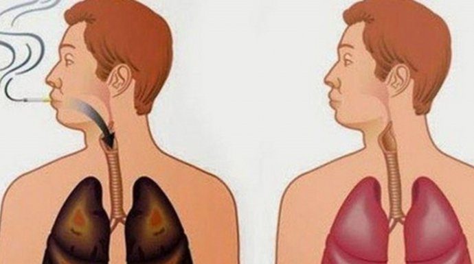 ISPRALA SAM KATRAN SA PLUĆA ZA SAMO 72 SATA I DOKTORI SU BILI IZNENAĐENI: Ovaj napitak čisti organizam, PROBAJTE I UVJERITE SE SAMI ISPRALA SAM KATRAN SA PLUĆA ZA SAMO 72 SATA I DOKTORI SU BILI IZNENAĐENI: Ovaj napitak čisti organizam, PROBAJTE I UVJERITE SE SAMI - featured image