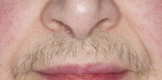 MASKA OD OVE BILJKE UKLANJA SVE DLAKE SA LICA ZAUVIJEK: Brzo zapišite RECEPT, poslije ovog dlake više ne rastu MASKA OD OVE BILJKE UKLANJA SVE DLAKE SA LICA ZAUVIJEK: Brzo zapišite RECEPT, poslije ovog dlake više ne rastu - featured image