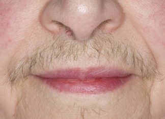 MASKA OD OVE BILJKE UKLANJA SVE DLAKE SA LICA ZAUVIJEK: Brzo zapišite RECEPT, poslije ovog dlake više ne rastu MASKA OD OVE BILJKE UKLANJA SVE DLAKE SA LICA ZAUVIJEK: Brzo zapišite RECEPT, poslije ovog dlake više ne rastu - featured image