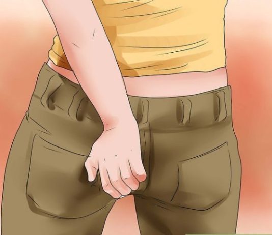 IZLIJEČILA SAM HEMEROIDE NA POTPUNO PRIRODAN NAČIN BEZ OPERACIJE: Uradite ovo i riješite se bola i muke! IZLIJEČILA SAM HEMEROIDE NA POTPUNO PRIRODAN NAČIN BEZ OPERACIJE: Uradite ovo i riješite se bola i muke! - featured image