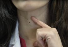 AKO IMATE PROBLEM SA ŠTITNOM ŽLIJEZDOM, OVE 2 NAMIRNICE IZBACITE: Štitna žlijezda ih nikako ne voli AKO IMATE PROBLEM SA ŠTITNOM ŽLIJEZDOM, OVE 2 NAMIRNICE IZBACITE: Štitna žlijezda ih nikako ne voli - featured image