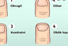 ODMAH POGLEDAJTE VAŠE PRSTE! KAKAV VAM JE OBLIK NOKTIJU? Evo šta to otkriva o vama, svima je pogodilo ODMAH POGLEDAJTE VAŠE PRSTE! KAKAV VAM JE OBLIK NOKTIJU? Evo šta to otkriva o vama, svima je pogodilo - featured image