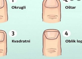 ODMAH POGLEDAJTE VAŠE PRSTE! KAKAV VAM JE OBLIK NOKTIJU? Evo šta to otkriva o vama, svima je pogodilo ODMAH POGLEDAJTE VAŠE PRSTE! KAKAV VAM JE OBLIK NOKTIJU? Evo šta to otkriva o vama, svima je pogodilo - featured image