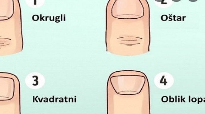 ODMAH POGLEDAJTE VAŠE PRSTE! KAKAV VAM JE OBLIK NOKTIJU? Evo šta to otkriva o vama, svima je pogodilo ODMAH POGLEDAJTE VAŠE PRSTE! KAKAV VAM JE OBLIK NOKTIJU? Evo šta to otkriva o vama, svima je pogodilo - featured image