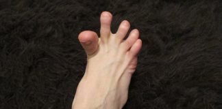 DA LI VAM SE GRČE PRSTI NA STOPALIMA? Evo na šta vas to upozorava, može biti znak većih problema DA LI VAM SE GRČE PRSTI NA STOPALIMA? Evo na šta vas to upozorava, može biti znak većih problema - featured image