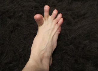 DA LI VAM SE GRČE PRSTI NA STOPALIMA? Evo na šta vas to upozorava, može biti znak većih problema DA LI VAM SE GRČE PRSTI NA STOPALIMA? Evo na šta vas to upozorava, može biti znak većih problema - featured image