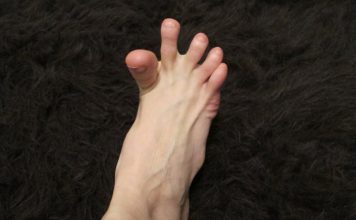 DA LI VAM SE GRČE PRSTI NA STOPALIMA? Evo na šta vas to upozorava, može biti znak većih problema DA LI VAM SE GRČE PRSTI NA STOPALIMA? Evo na šta vas to upozorava, može biti znak većih problema - featured image