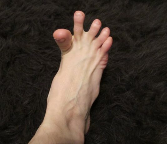 DA LI VAM SE GRČE PRSTI NA STOPALIMA? Evo na šta vas to upozorava, može biti znak većih problema DA LI VAM SE GRČE PRSTI NA STOPALIMA? Evo na šta vas to upozorava, može biti znak većih problema - featured image