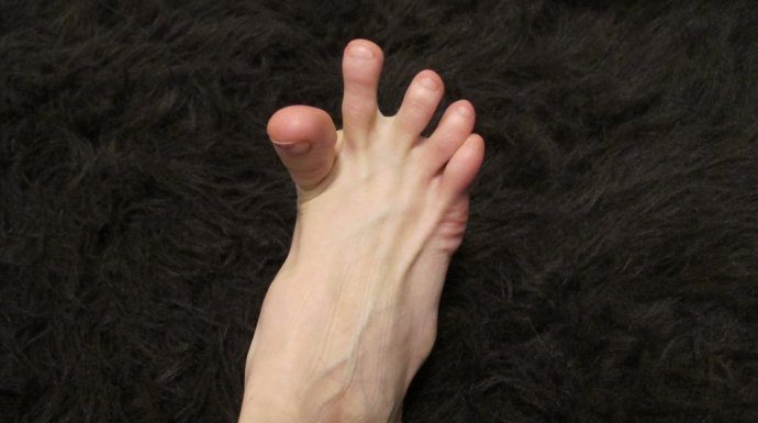 DA LI VAM SE GRČE PRSTI NA STOPALIMA? Evo na šta vas to upozorava, može biti znak većih problema DA LI VAM SE GRČE PRSTI NA STOPALIMA? Evo na šta vas to upozorava, može biti znak većih problema - featured image