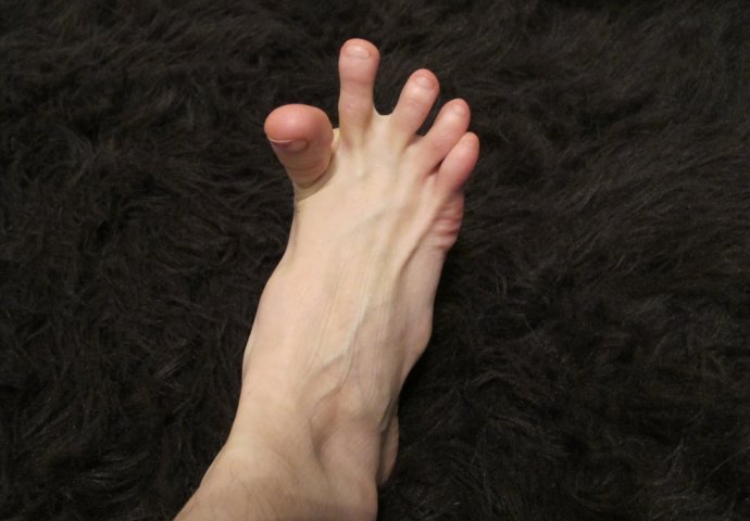 DA LI VAM SE GRČE PRSTI NA STOPALIMA? Evo na šta vas to upozorava, može biti znak većih problema - featured image DA LI VAM SE GRČE PRSTI NA STOPALIMA? Evo na šta vas to upozorava, može biti znak većih problema - featured image